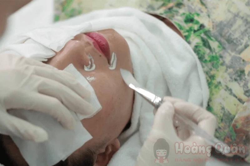 liệu trình peel da