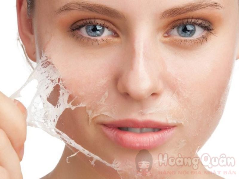 Da yếu có nên peel da không