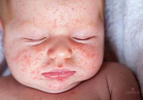 Sữa Modilac Expert Riz 3 giá tốt