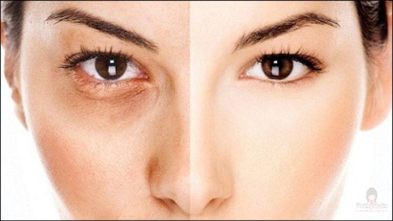 lí do bôi kem chống nắng bị cay mắt